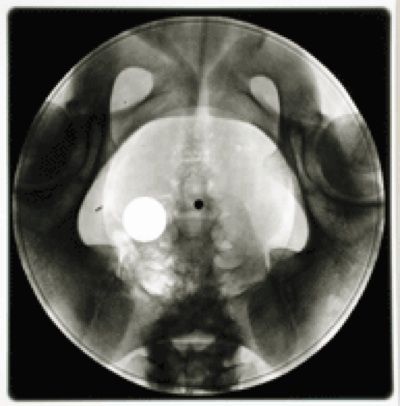 XRAY REX