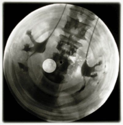 XRAY REX